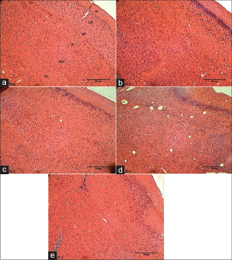 Figure 4: Photomicrographs of the frontal cortex. (a). Control Group indicating no histopathological changes. (b) 25 mg/kg caffeine group showing increase in cell density in the frontal cortex. (c) 30 mg/kg caffeine group showing increase in cell density in the frontal cortex. (d) 40 mg/kg caffeine group showing increase in cell density in the frontal cortex. (e) 60 mg/kg caffeine showing increase in cell density in the frontal cortex (H and E, ×100). M = Marginal zone; CP = Cortical plate; SP = Subcortical plate; IP = Intermediate plate; SVZ = Subventricular zone; VZ = Ventricular zone