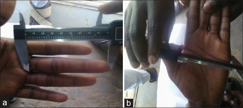 Figure 2: Procedure for measuring hand dimensions ([a] third digit length [b] palmar breath)