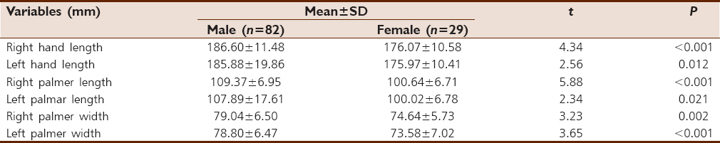 Table 1: Sexual dimorphism in hand dimension among 15-16 age groups