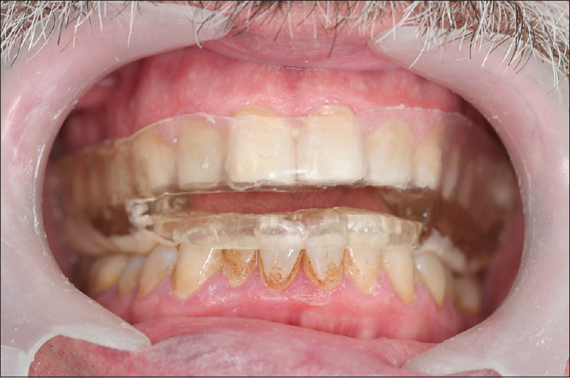 Figure 2: Intraoral view