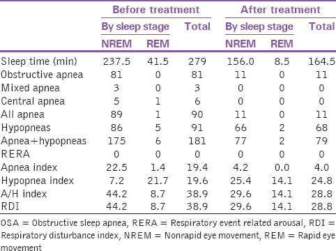 Table 1: Number of respiratory events-sleep stage (severe OSA patient)