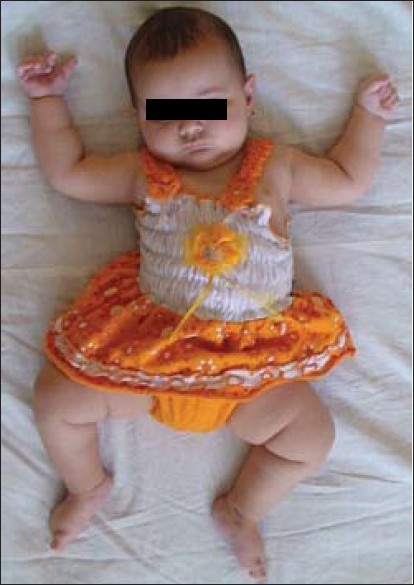 Figure 2: A normal female baby.