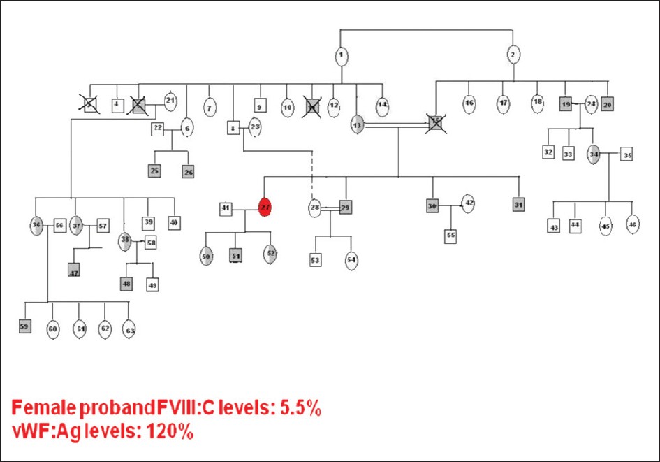 Figure 1: Pedigree of an extensive family with classical female hemophilia A