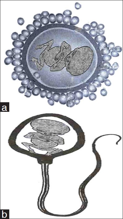 Figure 1: (a) Diagram representing the ovist hypothesis, (b) Miniature human in the head of spermatozoa (spermatic hypothesis)