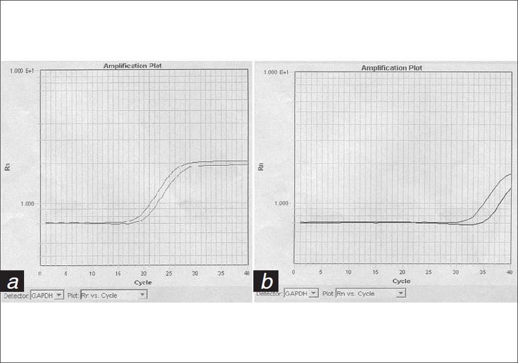 Figure 1: GAPDH amplification plots for genomic and plasma DNA samples. (a) Amplification for GAPDH in the human genomic male and female DNA control samples. (b) Amplification for GAPDH for two maternal plasma DNA samples - one carrying a male and the other carrying a female fetus