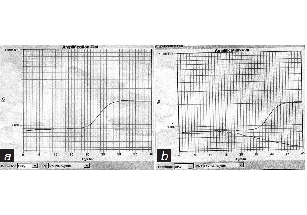 Figure 2: SRY amplification plots for genomic and plasma DNA samples. (a) Amplification for SRY in the human genomic male and female DNA control samples. (b) Amplification for SRY for two maternal plasma DNA samples - one carrying a male and the other carrying a female fetus