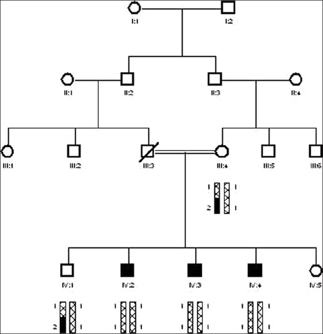 Figure 1: Family-10: Linked with locus DFNB1