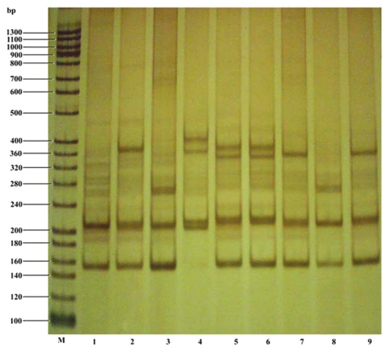 Figure 3: Silver stained native polyacrylamide gel showing PCR amplified CAG repeats of normal and expanded SCA1 alleles. The lane M represents 20bp ladder as molecular weight or size marker. Lanes 1, 2, 3, 4 and 9 represent expansion of SCA1 allele of affected individuals III12, III2, II11, III10 and II9, respectively. Lane 5, 6, 7, and 8 represent unaffected individuals III11, IV1, II8 and II10, respectively, in the pedigree. The individuals II8 and II10 are women of the family, who come from outside the family