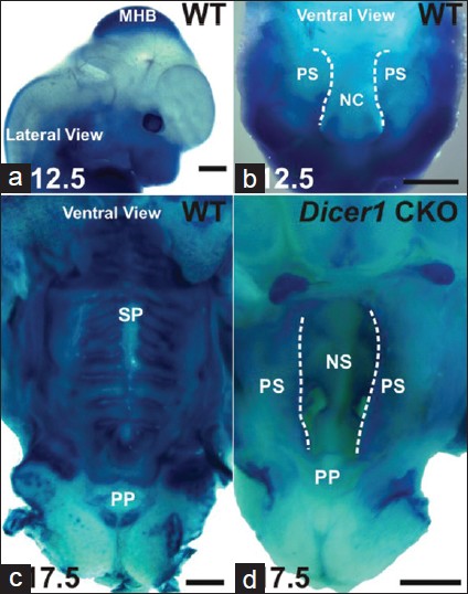 Figure 2: X - gal staining in <i>Pax2-Cre/DicerloxP/WT/ Rosa26R</i> (a-c) and <i>Dicer1</i> CKO (d) mice. MHB: mid-hindbrain; PS: palatal shelf; NC: nasal cavity; NS: nasal septum; PP: primary palate; SP: secondary palate. Bar = 50 μm (a, b); 1mm (c, d). Palatal rim delineated by dotted line