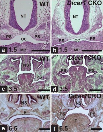 Figure 4: Comparative palatal development. a, c, e. WT. b, d, f. <i>Dicer1</i> CKO. NT: neural tube; MP: mandibular process; PS: palatal shelves; OC: oral cavity; P: secondary palate; NS: nasal septum; T: tongue. Bar = 1mm (a, b); 500 μm (c-f). H and E staining