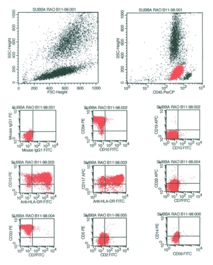 Figure 3: Scatter plots on immunophenotyping - the gated population of neoplastic cells showed bright positivity for HLA-DR, moderate positivity for CD34, CD33, dim to moderate for CD117, CD13 negativity for CD10, CD19, CD7, CD22, CD5, CD2, CD14, CD56