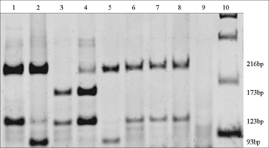 Figure 1: Polyacrylamide gel at 6%, stained with SYBR® Gold nucleic acid stain: (1) Normal subject control; (2) deaf subject control, with the A1555G mutation; (3 and 4) deaf patients with polymorphism T1291C; (5) deaf patient with the A1555G mutation; (6, 7 and 8) normal hearing patients with no mutation; (9) control without DNA and (10) molecular marker (ladder 100 bp)