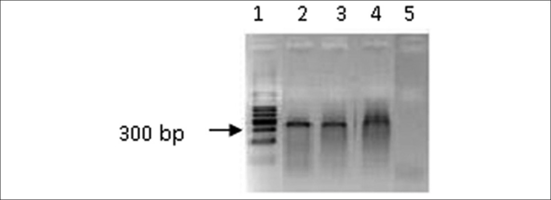 Figure 1: Polymerase chain reaction amplification of Fragile X mental retardation gene 5' region using a serial dilution of genomic DNA in the presence of betaine (1.0 M) and dimethyl sulfoxide (5%). Lane 1: 100 bp ladder, Lane 2: 10 ng, Lane 3: 15 ng, Lane 4: 25 ng, Lane 5: Negative control (without DNA). The cycle conditions: Initial denaturation 94°C for 15 s followed by 40 cycles of denaturation at 94°C for 15 s, annealing at 65°C for 2 min, and extension at 68°C for 5 min for 40 cycles