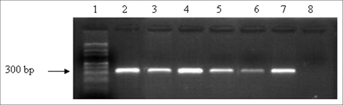 Figure 2: Polymerase chain reaction amplification of Fragile X mental retardation gene 5' region under optimized conditions using buccal cell DNA. Lane 1:100 bp ladder, Lane 2 - 7: Representative samples (50 ng), Lane 8: Negative control (without DNA)