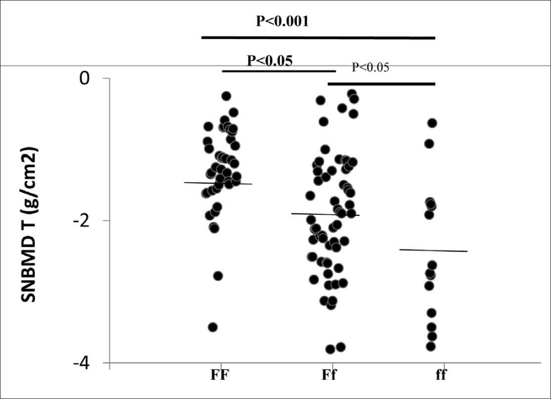 Figure 1: The distribution of spinal bone mineral density T-score on the three <i>FokI</i> genotypes in patients