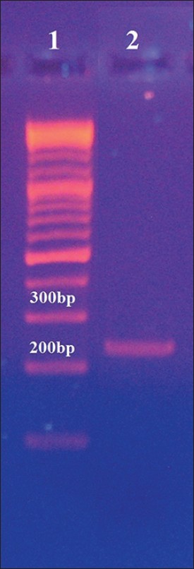Figure 1: Confirmation of polymerase chain reaction amplification using gel electrophoresis. Lane 1: 100 bp deoxyribonucleic acid ladder; Lane 2: PCR products from peroxisome proliferator-activated receptor-GAMMA2 gene using the forward and reverse primers mentioned in the method section. Extracted DNA from peripheral blood was used as template