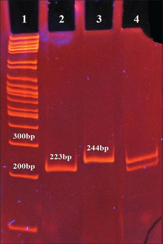 Figure 2: Polymerase chain reaction-RFLP detection of the Pro12Ala polymorphism of peroxisome proliferator - activated receptor - GAMMA2 gene using gel electrophoresis. Lane 1: 100 bp deoxyribonucleic acid ladder; lane 2: Ala12 homozygotes; lane 3: Pro12 homozygotes; lane 4: Pro12Ala heterozygotes. Extracted DNA from peripheral blood was used as template