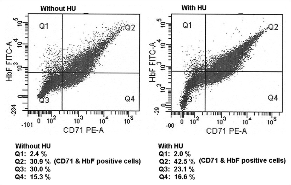 Figure 1: Flow cytometric estimation of CD71 and fetal cells on cultured erythroid cells before and after addition of hydroxyurea