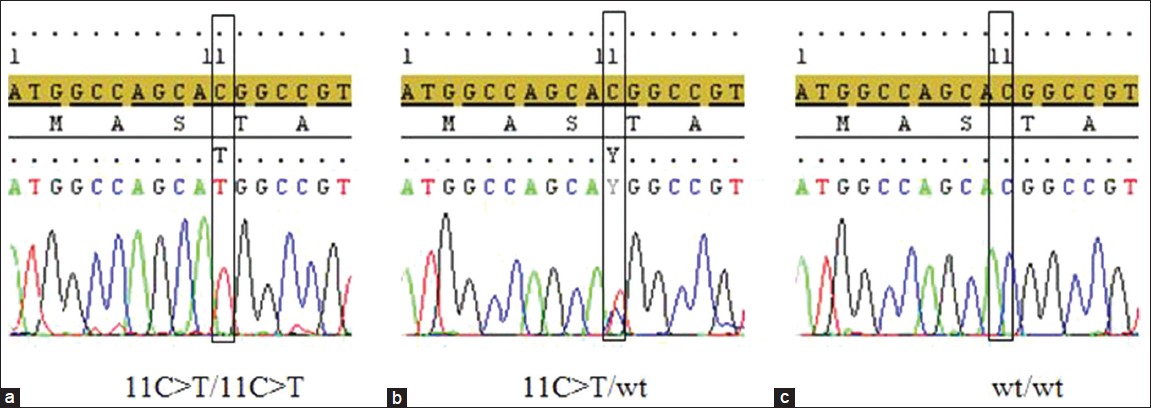 Figure 2: Sequence chromatograms showing the c.11C>T (threonine to methionine at position 4) variant in the <i>CLDN14</i> gene. (a) homozygous deaf patient (c.11C>T/c.11C>T), (b) Heterozygous deaf patient (c.11C>T/wt), (c) Homozygous individual with the wild type variant (wt/wt)