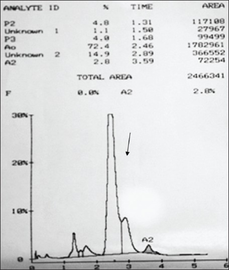 Figure 1: High-performance liquid chromatography chromatogram showing the unknown peak at retention time .89 min