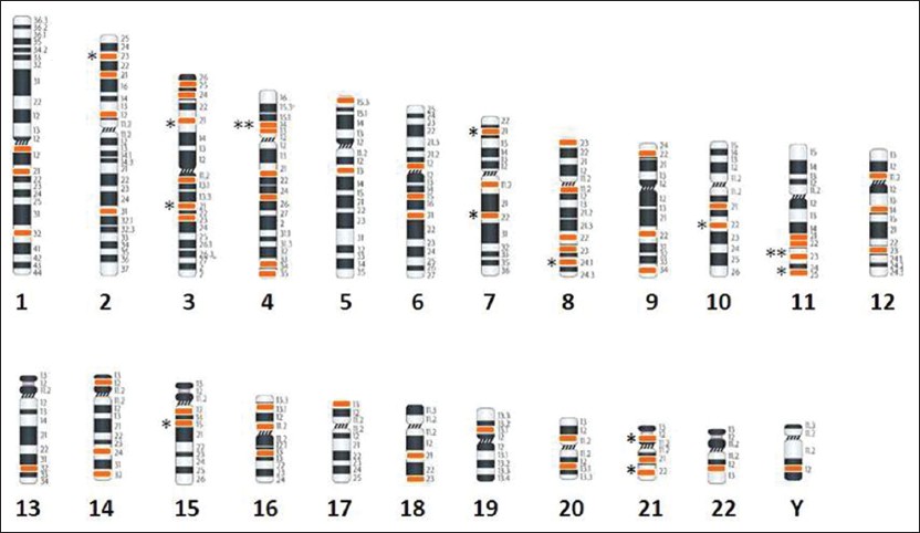 Figure 1: Breakpoint distribution is based on cytogenetic data shown in Table 3. Chromosomes are arranged according to the number except X chromosome as no break point was detected. Below each chromosome the black color numerical indicates the chromosome number and the break points are colored according to the number of break observed in the study. Each star represent on the left of chromosome indicates if a breakpoint was observed in more than one case