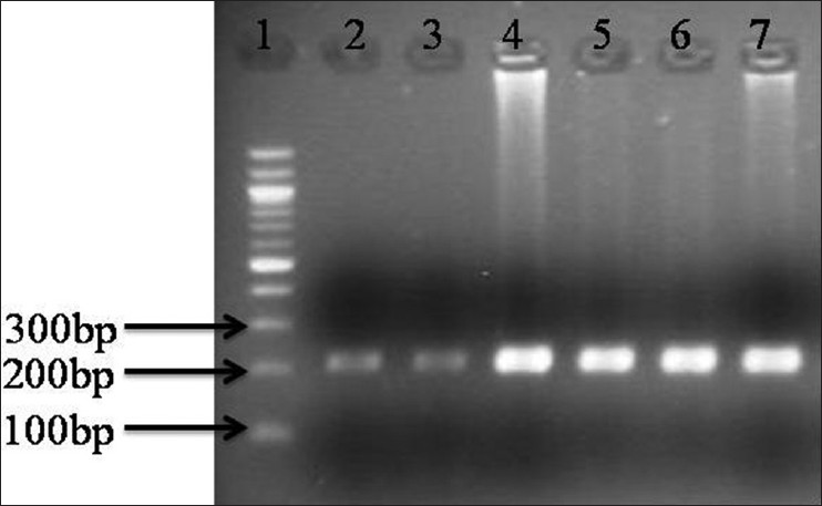 Figure 1: 2% Agarose gel showing polymerase chain reaction (PCR) product of fibroblast growth factor receptor 1 amplification (216 bp) (1) Molecular maker (100 bp); (2-7) PCR prdocut of craniosynostosis and and non-craniosynostosis children