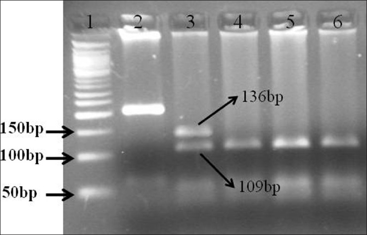 Figure 2: Restriction fragment length polymorphism of polymerase chain reaction (PCR) product of fibroblast growth factor receptor 1 on 3% Agarose gel from craniosynostosis and non-craniosynostosis children's which were analysis for MnlI digestion. (1) Molecular marker (50 bp); (2) PCR product for craniosynostosis children's; (3) Completely digested PCR product for craniosynostosis children's (GC) (136 bp, 109 bp); (4 and 5) Completely digested PCR product for non-craniosynostosis children's (CC) (109 bp)