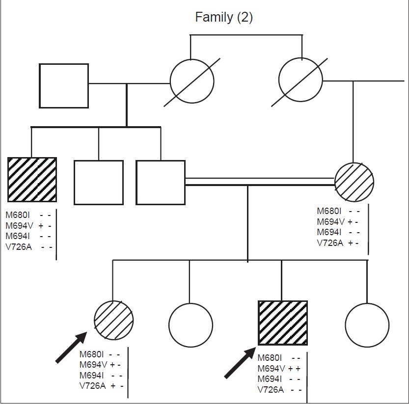Figure 2: Pedigree of a multiplex familial Mediterranean fever (FMF) family presented with positive consanguinity and two affected offsprings; 24-years woman (typed like her mother M694V/V726A) and 15-year-old boy (typed as homozygous M694V). Their uncle had moderate FMF symptoms (58 years), genotyped as M694V/Unidentified. Allele M694V is common in all affected members. Empty squares and circles are non-tested, filled squares and circles are symptomatic FMF cases