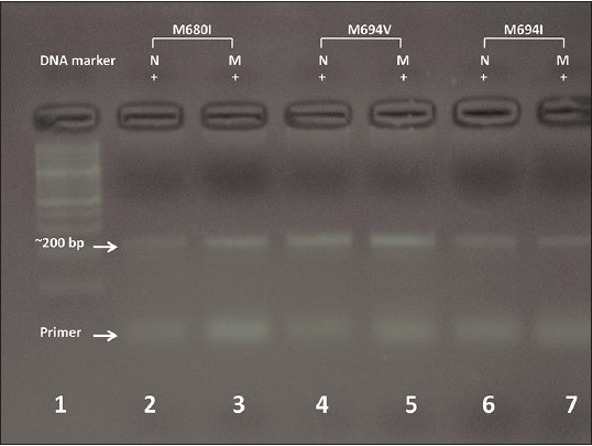 Figure 3: Deoxyribonucleic acid (DNA) electrophoresis of amplified segments of familial Mediterranean fever gene (~200 bp, upper arrow) using normal and mutant primers corresponding to each of the four studied mutations, the distal fragment is that of primer (bottom arrow). Lane 1 is a marker DNA, lanes 2, 3 heterozygous mutants M680I, lanes 4, 5 heterozygous mutant M694V and lanes 6, 7 heterozygous mutants M694I