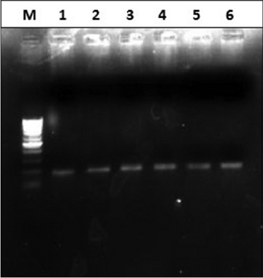 Figure 1: Representative gel picture of CACNA1A gene E993V target