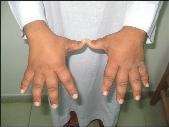 Figure 3: Large hands