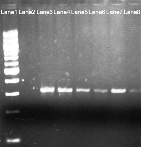 Figure 1: Two percent agarose gel, polymerase chain reaction (PCR) product before Hinf I restriction fragment length polymorphism; Lane 1 - 100 bp ladder; Lane 2 - Blank; Lanes 3, 4, 5, 6, 7 and 8 - PCR product of 315 bp