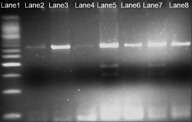 Figure 2: Three percent agarose gel, Hinf I restriction fragment length polymorphism analysis of methylenetetrahydrofolate reductase 677; Lane 1-50 bp ladder; Lanes 2, 3, 4, 6 and 8 - homozygous wild type; Lane 5 and 7 -heterozygous polymorphic