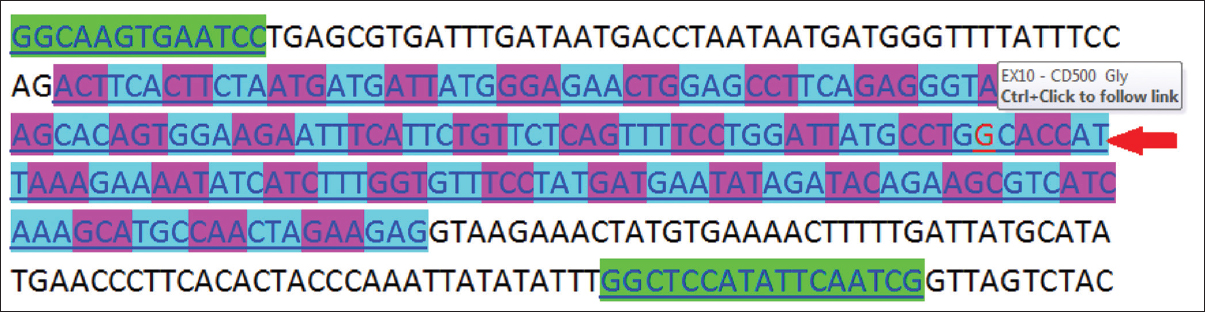 Figure 3: Identification of mutation in Exon 10 of cystic fibrosis transmembrane conductance regulator gene