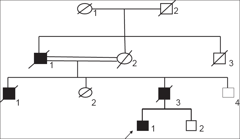 Figure 3: Pedigree chart showing proband (D-1) and affected members of the family (B-1), (C-1) and (C-3). Consanguineous marriage is evident between B-1 and B-2. Male to male transmission is evident two levels