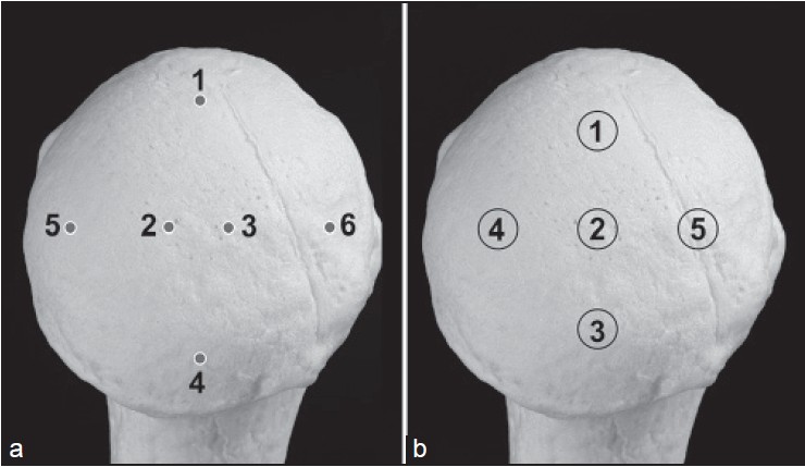 Figure 2: (a) Penetrometer test spots. (b) Location of bone cylinders harvested from the subchondral bone of the humeral head.