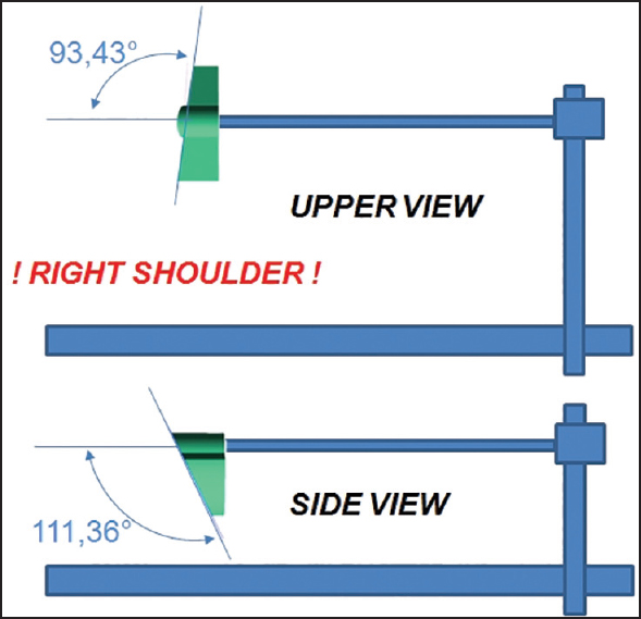 Figure 5: Upper view and side view schematically of the glenoid aiming device for right shoulder
