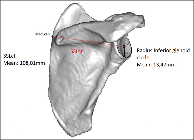 Figure 8: At the rim of the inferior glenoid quadrants we measured the best fitting circle. The center of the inferior glenoid circle was called Gc. The most medial point of the spina scapula was called MedScap. The line between MedScap and Gc was called the spinal scapular length (SSLct). The SSLct and the radius of the inferior glenoid circle were measured
