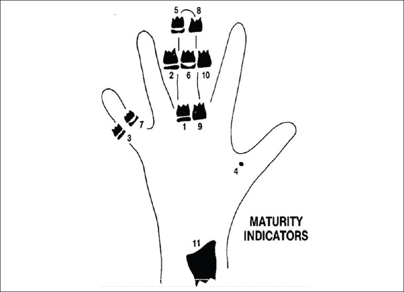 Figure 1: Eleven skeletal maturity indicators