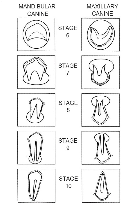 Figure 2: Nolla's calcifi cation stages of maxillary and mandibular canine