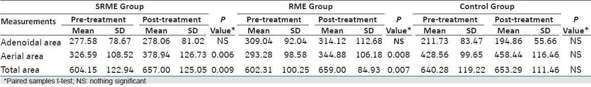 Table 2: Comparision of pre- and post-treatment measurements