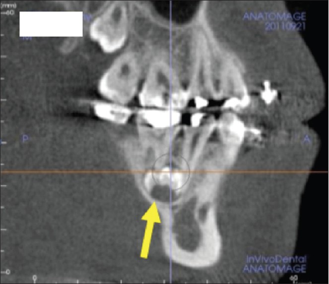 Figure 9: Dental anomaly. Supernumerary teeth