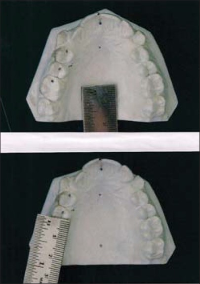 Figure 2: Magnification correction