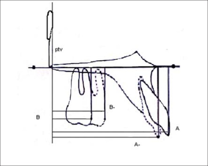 Figure 4: Tooth movement measurements