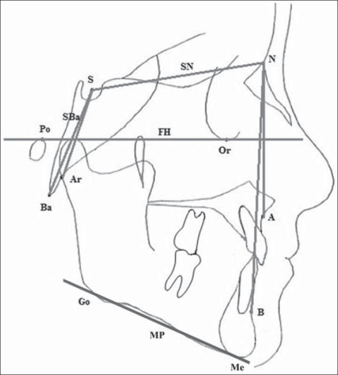 Figure 1: The measurement points and reference lines used in the study: A point (A), B point (B), sella (S), nasion (N), articulare (Ar), basion (Ba), gonion intersection (Go), menton (Me), porion (Po), orbitale (Or), anterior cranial base (SN), sagittal growth pattern (ANB), vertical growth pattern (SN-MP), Frankfort horizontal plane (FH), cranial base flexures (N-S-Ar, N-S-Ba), anterior and posterior cranial base inclinations (SN-FH, SBa-FH), and cranial base dimensions (S-N, S-Ba)