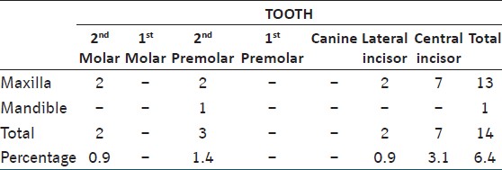 Table 3: Prevalence and incidence of hyperdonti a (including mesiodens)