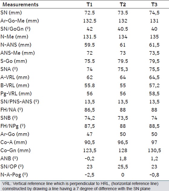 Table 1: Skeletal measurements of the pati ent at T1, T2 and T3