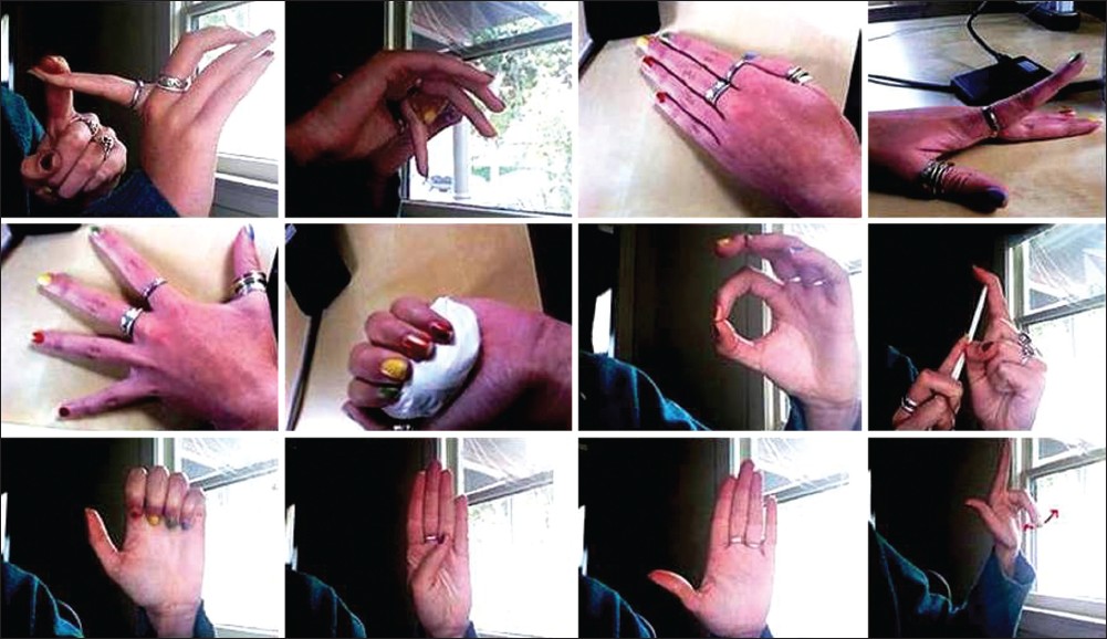 Figure 5: Fingers and thumbs strengthening exercises