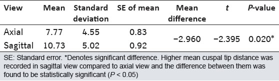 Table 4: Comparison of cuspal tip distance between axial and sagittal views