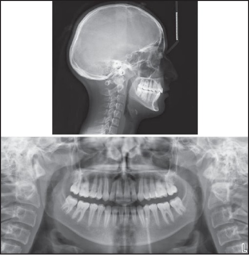 Figure 9: Post-treatment lateral cephalogram and panoramic radiographs